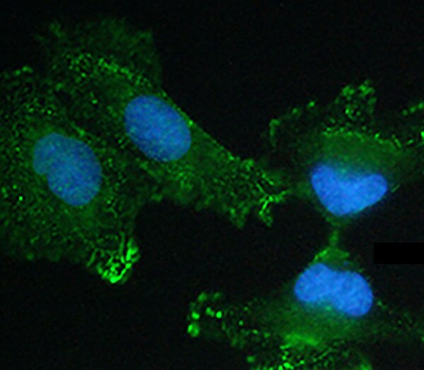 IF of HTB-66 cells labeled with DSHB antibody CPTC-MSN-1 against moesin. Image credit: Soll Laboratory, University of Iowa. 